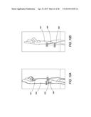 Personnel Screening System diagram and image