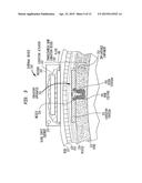 CONTRALATERAL SOUND CAPTURE WITH RESPECT TO STIMULATION ENERGY SOURCE diagram and image