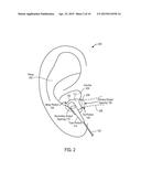 EARPHONE HAVING AN ACOUSTIC TUNING MECHANISM diagram and image