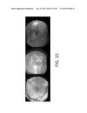 SYSTEMS AND METHODS FOR PROCESSING RETINAL IMAGES FOR SCREENING OF     DISEASES OR ABNORMALITIES diagram and image