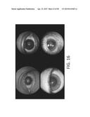 SYSTEMS AND METHODS FOR PROCESSING RETINAL IMAGES FOR SCREENING OF     DISEASES OR ABNORMALITIES diagram and image