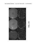 SYSTEMS AND METHODS FOR PROCESSING RETINAL IMAGES FOR SCREENING OF     DISEASES OR ABNORMALITIES diagram and image