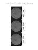 SYSTEMS AND METHODS FOR PROCESSING RETINAL IMAGES FOR SCREENING OF     DISEASES OR ABNORMALITIES diagram and image