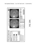 SYSTEMS AND METHODS FOR PROCESSING RETINAL IMAGES FOR SCREENING OF     DISEASES OR ABNORMALITIES diagram and image