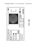 SYSTEMS AND METHODS FOR PROCESSING RETINAL IMAGES FOR SCREENING OF     DISEASES OR ABNORMALITIES diagram and image