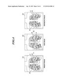 Medical Image Processing Apparatus And Computer-Readable Storage Medium diagram and image