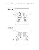 Medical Image Processing Apparatus And Computer-Readable Storage Medium diagram and image