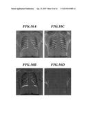 Medical Image Processing Apparatus And Computer-Readable Storage Medium diagram and image