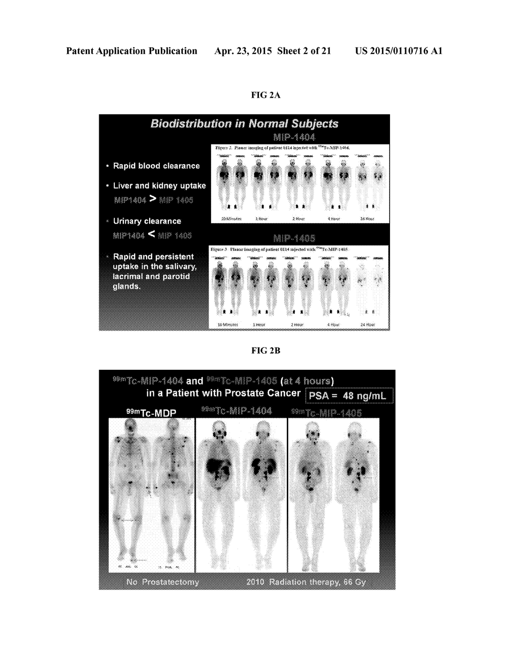 METHODS OF USING SPECT/CT ANALYSIS FOR STAGING CANCER - diagram, schematic, and image 03