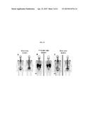 METHODS OF USING SPECT/CT ANALYSIS FOR STAGING CANCER diagram and image