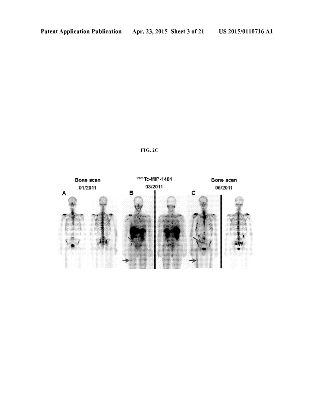 METHODS OF USING SPECT/CT ANALYSIS FOR STAGING CANCER - diagram, schematic, and image 04