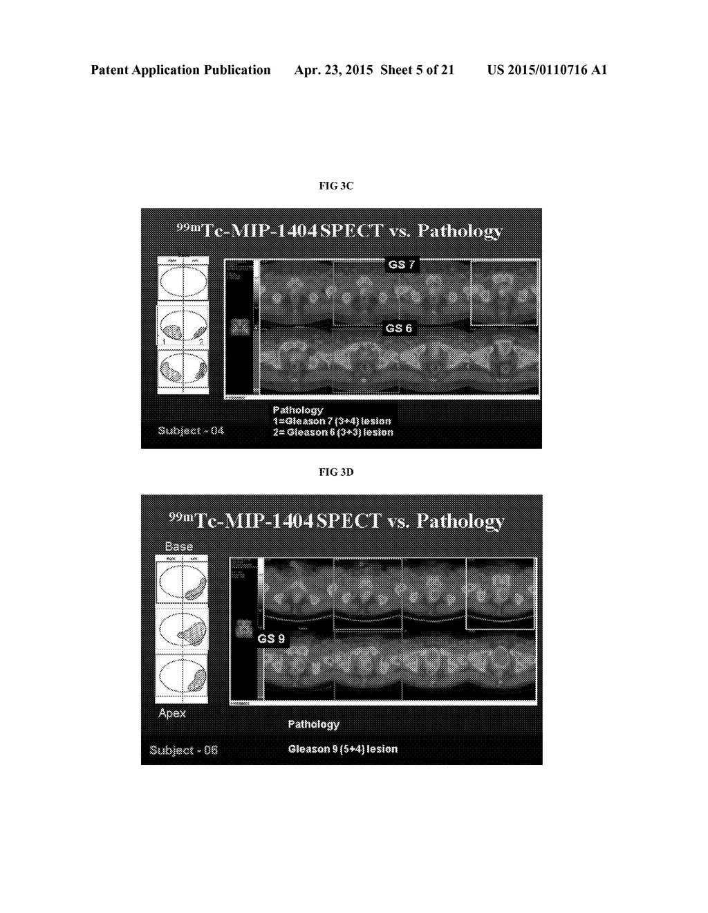 METHODS OF USING SPECT/CT ANALYSIS FOR STAGING CANCER - diagram, schematic, and image 06