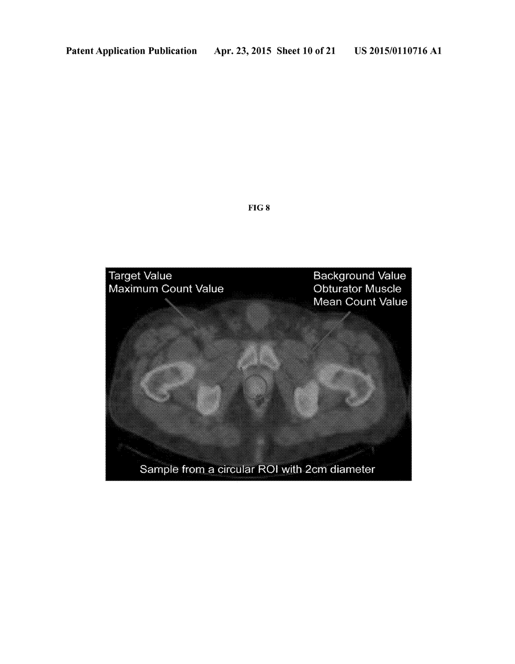 METHODS OF USING SPECT/CT ANALYSIS FOR STAGING CANCER - diagram, schematic, and image 11