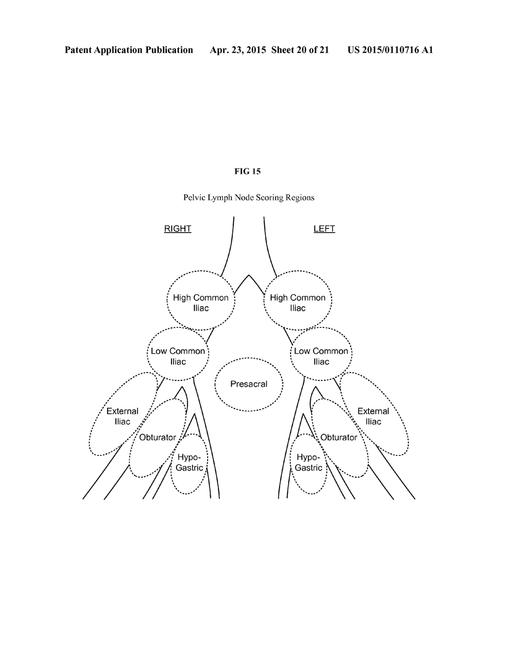 METHODS OF USING SPECT/CT ANALYSIS FOR STAGING CANCER - diagram, schematic, and image 21