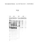 YEAST-BASED THERAPEUTIC FOR CHRONIC HEPATITIS B INFECTION diagram and image