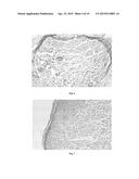 Cell Homogenate From Stem Cells Derived From Growing Deer Antlers, A     Method Of Obtaining It And Its Use diagram and image