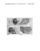 Cell Homogenate From Stem Cells Derived From Growing Deer Antlers, A     Method Of Obtaining It And Its Use diagram and image