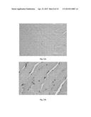 Cell Homogenate From Stem Cells Derived From Growing Deer Antlers, A     Method Of Obtaining It And Its Use diagram and image