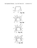 METHOD OF MAKING A DENTAL RESTORATION THAT INHIBITS TOOTH DEMINERALIZATION diagram and image