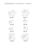 METHOD OF MAKING A DENTAL RESTORATION THAT INHIBITS TOOTH DEMINERALIZATION diagram and image