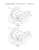 JIGS FOR PLACING DENTAL IMPLANT ANALOGS IN MODELS AND METHODS OF DOING THE     SAME diagram and image