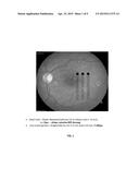 OPTICAL REGULATION OF GENE EXPRESSION IN THE RETINA diagram and image