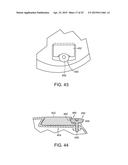 GOLF CLUB HAVING REMOVABLE WEIGHT diagram and image