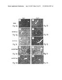 Endothelial Cell-Specific Polynucleotides and Use Thereof diagram and image