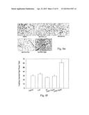 Endothelial Cell-Specific Polynucleotides and Use Thereof diagram and image