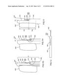 SYSTEMS AND METHODS FOR MONITORING ENDOLUMINAL VALVE FORMATION diagram and image