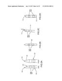 SYSTEMS AND METHODS FOR MONITORING ENDOLUMINAL VALVE FORMATION diagram and image