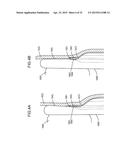 SYSTEMS AND METHODS FOR MONITORING ENDOLUMINAL VALVE FORMATION diagram and image