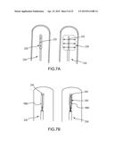 SYSTEMS AND METHODS FOR MONITORING ENDOLUMINAL VALVE FORMATION diagram and image