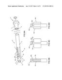 SYSTEMS AND METHODS FOR MONITORING ENDOLUMINAL VALVE FORMATION diagram and image