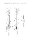 SYSTEMS AND METHODS FOR MONITORING ENDOLUMINAL VALVE FORMATION diagram and image