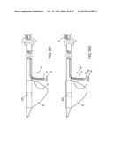 SYSTEMS AND METHODS FOR MONITORING ENDOLUMINAL VALVE FORMATION diagram and image