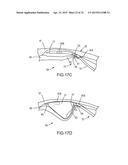 SYSTEMS AND METHODS FOR MONITORING ENDOLUMINAL VALVE FORMATION diagram and image