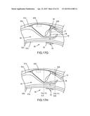 SYSTEMS AND METHODS FOR MONITORING ENDOLUMINAL VALVE FORMATION diagram and image