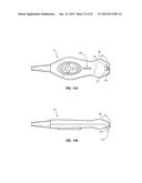 Needle Guide Including Enhanced Visibility Entrance diagram and image