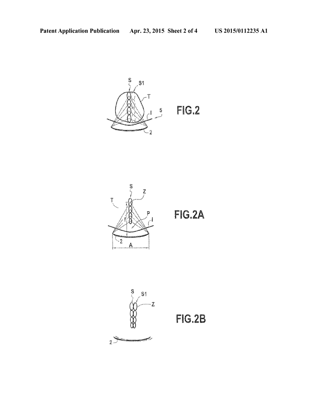 APPARATUS FOR GENERATING FOCUSED ULTRASOUND WAVES WITH REDUCED TREATMENT     TIME - diagram, schematic, and image 03