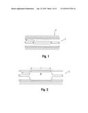 MEDICAL BALLOON WITH MULTI-POSITION ACTUATOR FOR PRECISELY ARRANGING THE     WORKING SURFACE diagram and image