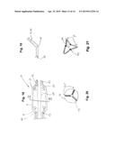 MEDICAL BALLOON WITH MULTI-POSITION ACTUATOR FOR PRECISELY ARRANGING THE     WORKING SURFACE diagram and image