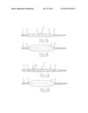 BALLOON CATHETER AND METHOD FOR MANUFACTURING IT diagram and image