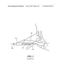 Systems and Methods for Needle for Subclavian Vein Penetration diagram and image