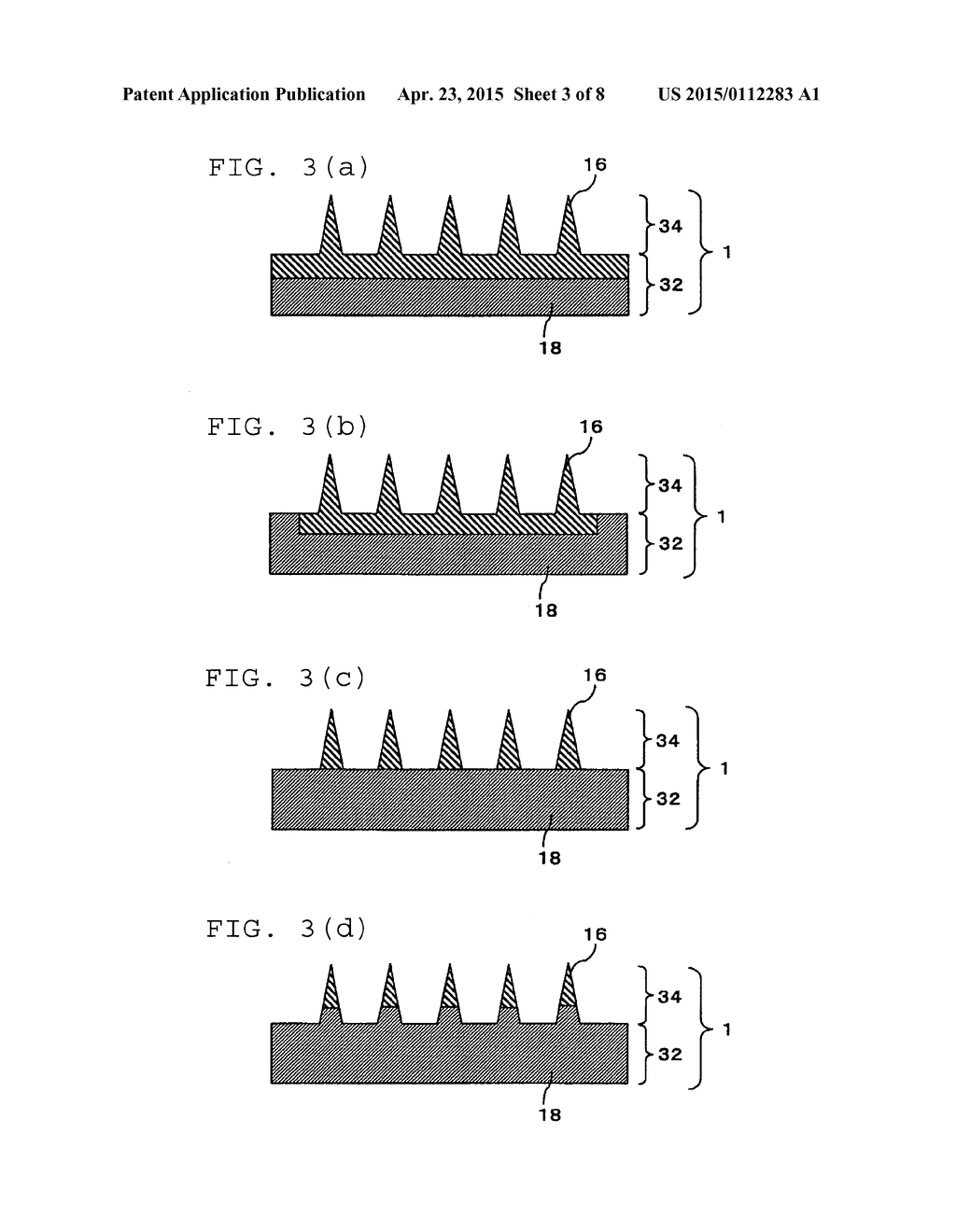 NEEDLE-SHAPED BODY AND METHOD FOR MANUFACTURING NEEDLE-SHAPED BODY - diagram, schematic, and image 04