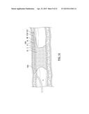 APPARATUS HAVING A SELECTIVELY CURVED DISTAL END AND METHODS FOR USE diagram and image