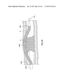 APPARATUS HAVING A SELECTIVELY CURVED DISTAL END AND METHODS FOR USE diagram and image