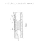 APPARATUS HAVING A SELECTIVELY CURVED DISTAL END AND METHODS FOR USE diagram and image