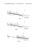 METHOD INVOLVING USE OF AN ASSEMBLED INDWELLING ASSEMBLY diagram and image