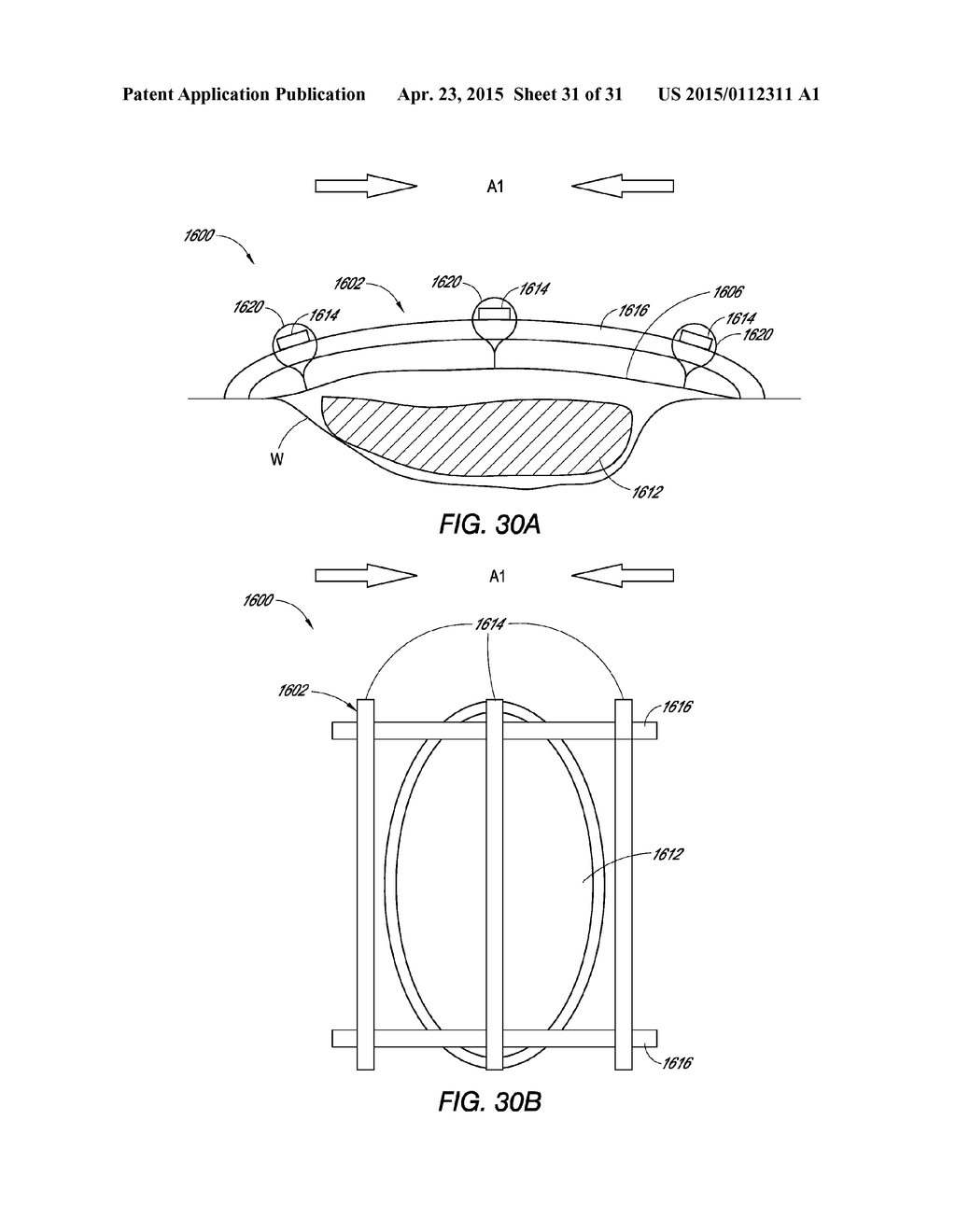 WOUND CLOSURE DEVICE - diagram, schematic, and image 32